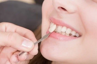 patient comparing dental veneers with natural tooth color