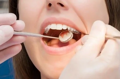 woman patient getting dental checkup