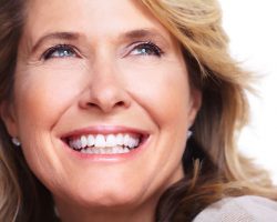Start Smiling With Dental Veneers